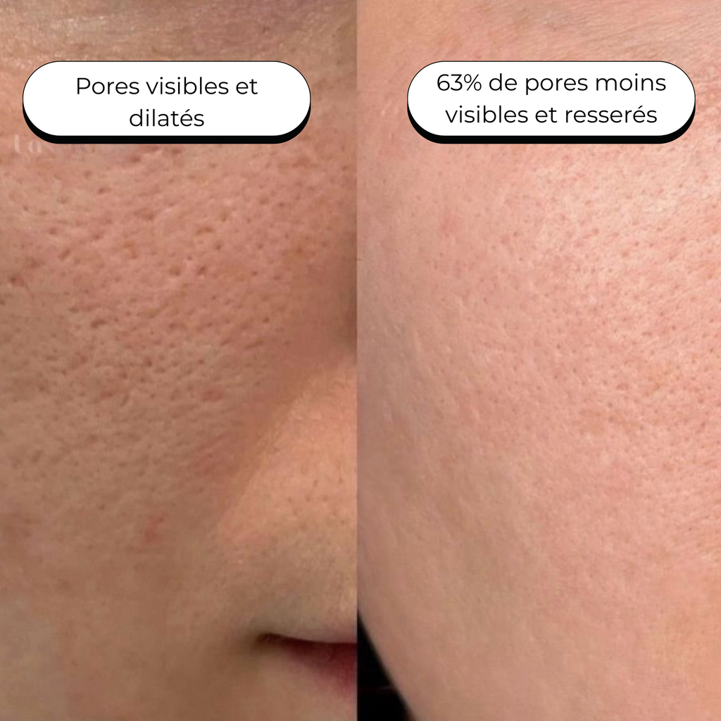 Masque au Collagène